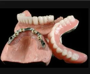 dentures