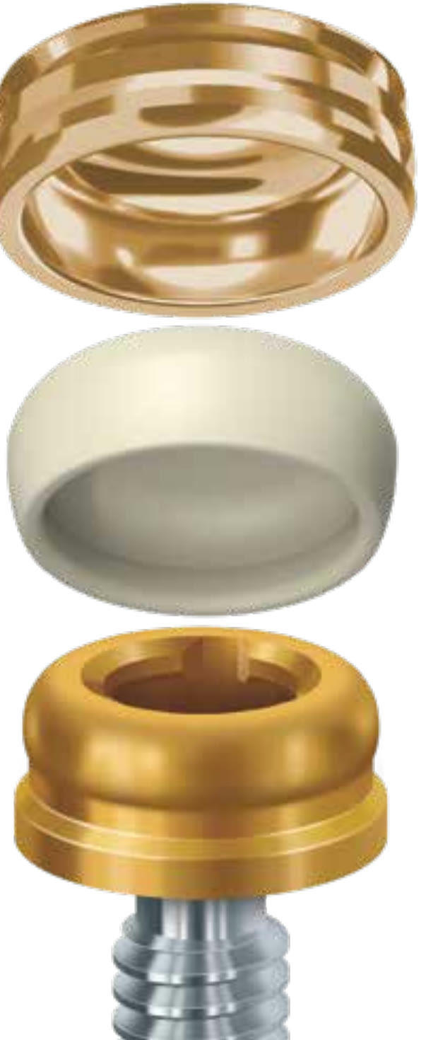 Exploded view of the LOCATOR FIXED components: gold prosthesis housing, rigid insert, and the LOCATOR abutment on an implant